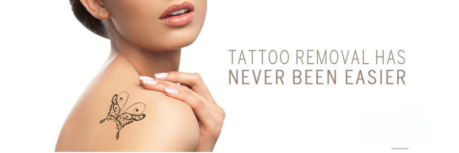 tattoo-removal-treatment-banner